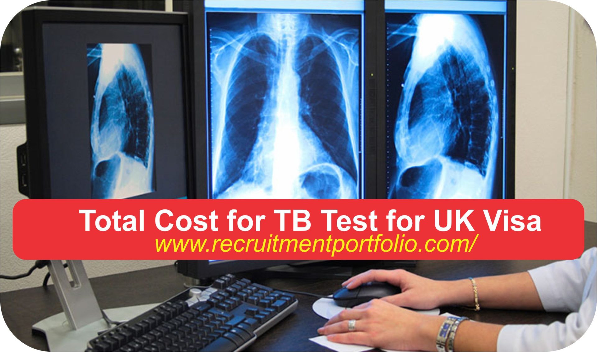 Total Cost for TB Test for UK Visa in 2024